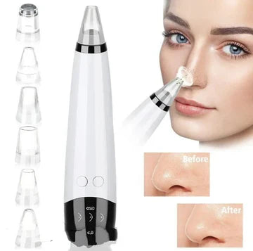 VACUUM BLACKHEAD REMOVER MACHINE